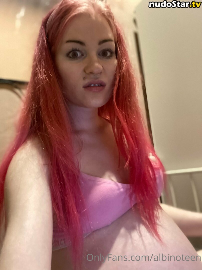 albinoteen Nude OnlyFans Leaked Photo #4