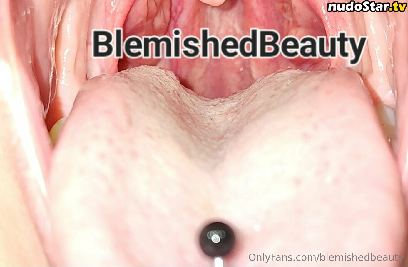 blemishedbeauty Nude OnlyFans Leaked Photo #85