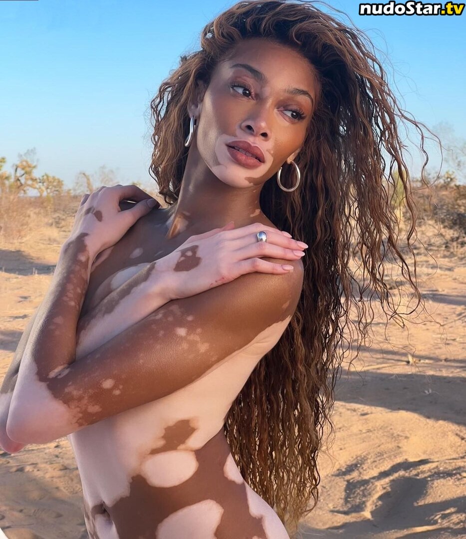 Winnie Harlow / winnieharlow Nude OnlyFans Photo #124 - Nudostar.TV